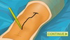 Virtual Knee Surgery screenshot