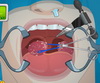 Operate Now Tonsil Surgery szimulátorok játék